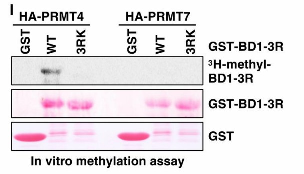Advancements in Protein lipidation Research